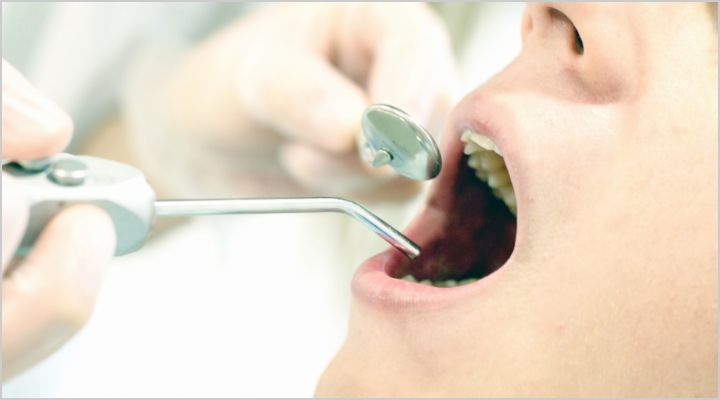 一般歯科・予防歯科